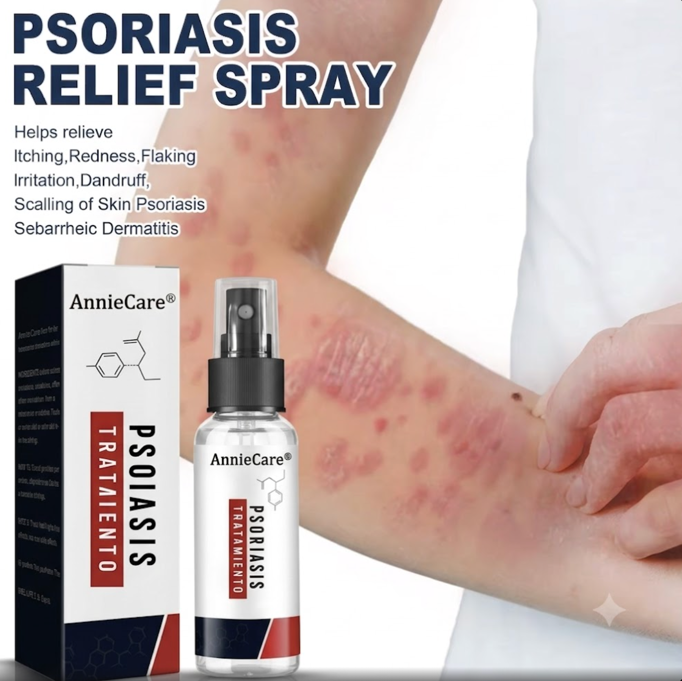 AnnieCare® Spray para el tratamiento de la psoriasis 2X1 TRATAMIENTO COMPLETO ✅
