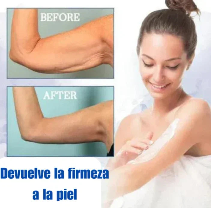 ✨🩵𝟕𝟎% 𝐎𝐅𝐅🌸𝐅𝐮𝐛𝐬𝐭𝐚® -Recupera la elasticidad de la piel⭐ 300ML