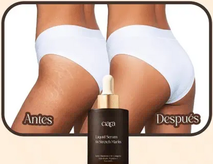 Serum anti estrias- PROMOCION POR ESTES MES✅