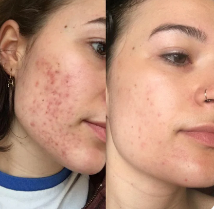 Glow Clear Kit Serum+Toallitas