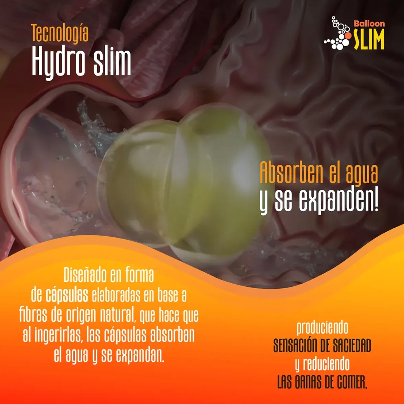 Pierde peso sin riesgos ni cirugías con Balloon SLIM™ OFERTA ESTE MES ✅