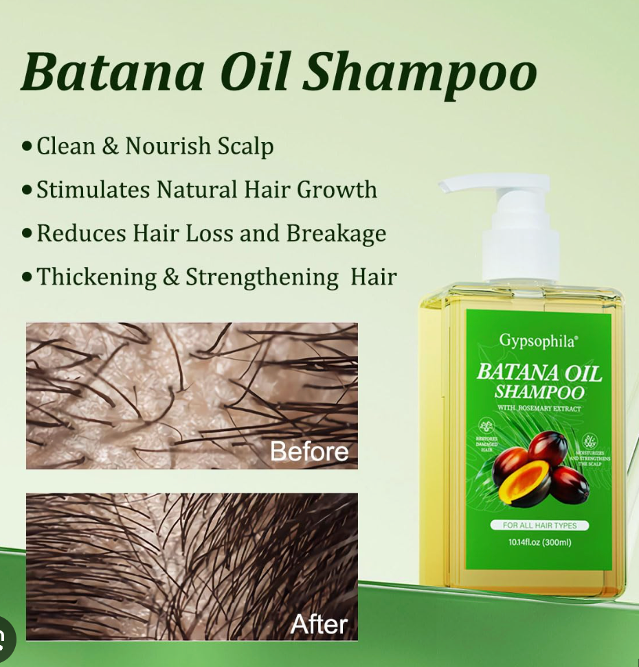 💆🏻‍♀️¡NUEVO! SHAMPOO Y ACEITE DE BATANA Evita la Caída y Obtén un Crecimiento de Cabello abundante