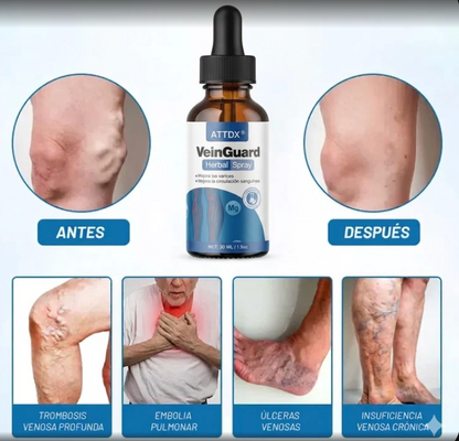 VEINGUARD Herbal Spray | Desinflama y Mejora la Circulación. OFERTA 2X1  ✅