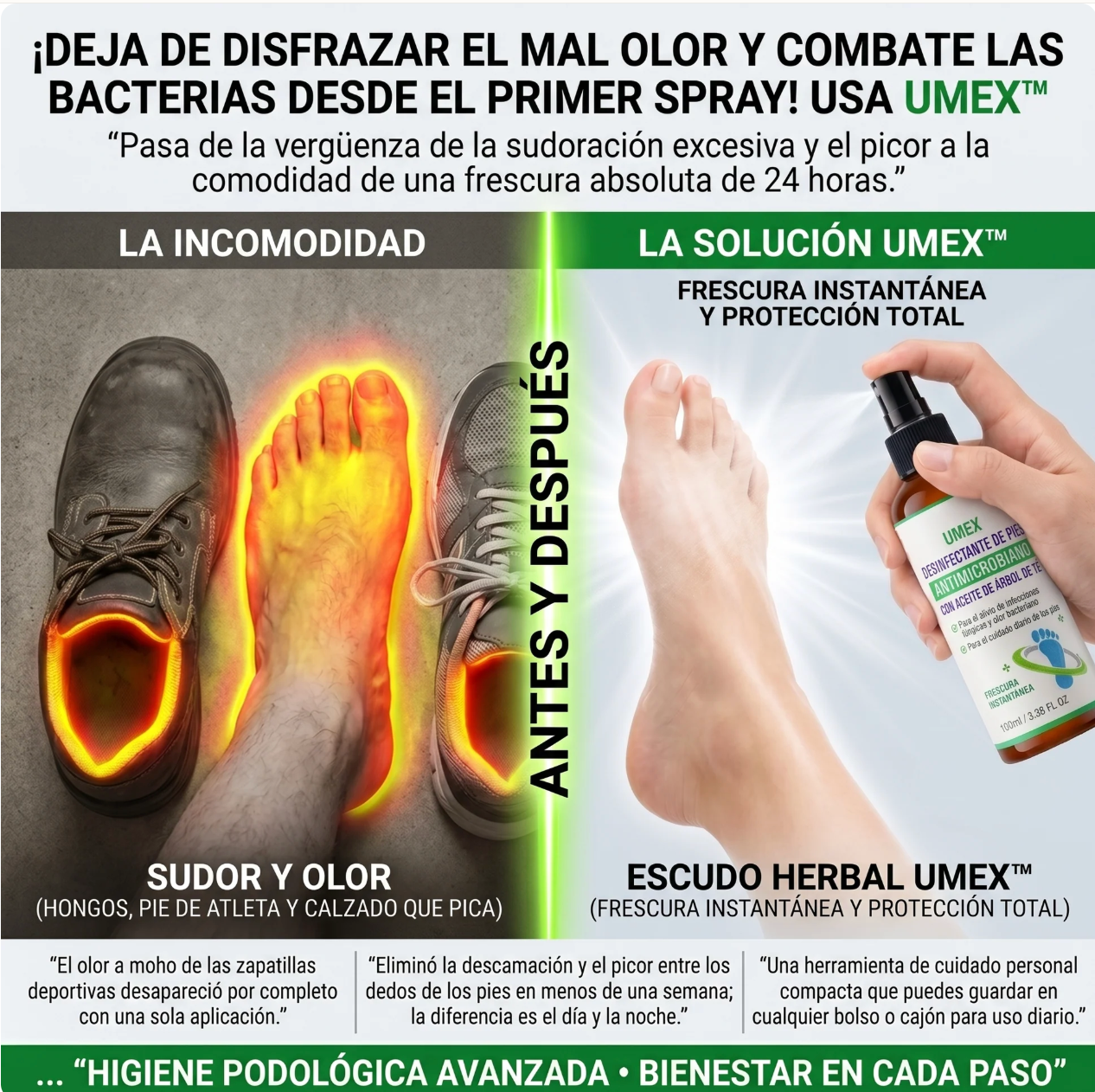 Umex™ Spray sanitizante e hipoalergénico para pies y calzado