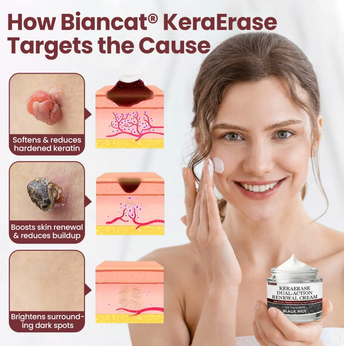 Crema renovadora de doble acción Biancat® KeraErase