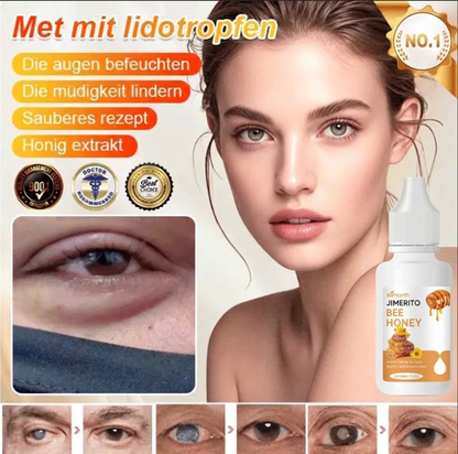 Gotas oftálmicas de miel Jimerito OFTÁLMICAS MILAGROSAS PARA PROBLEMAS DE OJOS/ 🔥 ENVIO POR MRW A TODA VENEZUELA 🇻🇪   EL PAGO DEBE SER ANTICIPADO SI NO DESEA ASI NO HAGA SU PEDIDO GRACIAS ✅